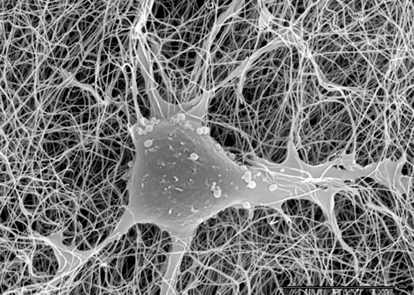 How Fascia Moves (Fascial Properties)