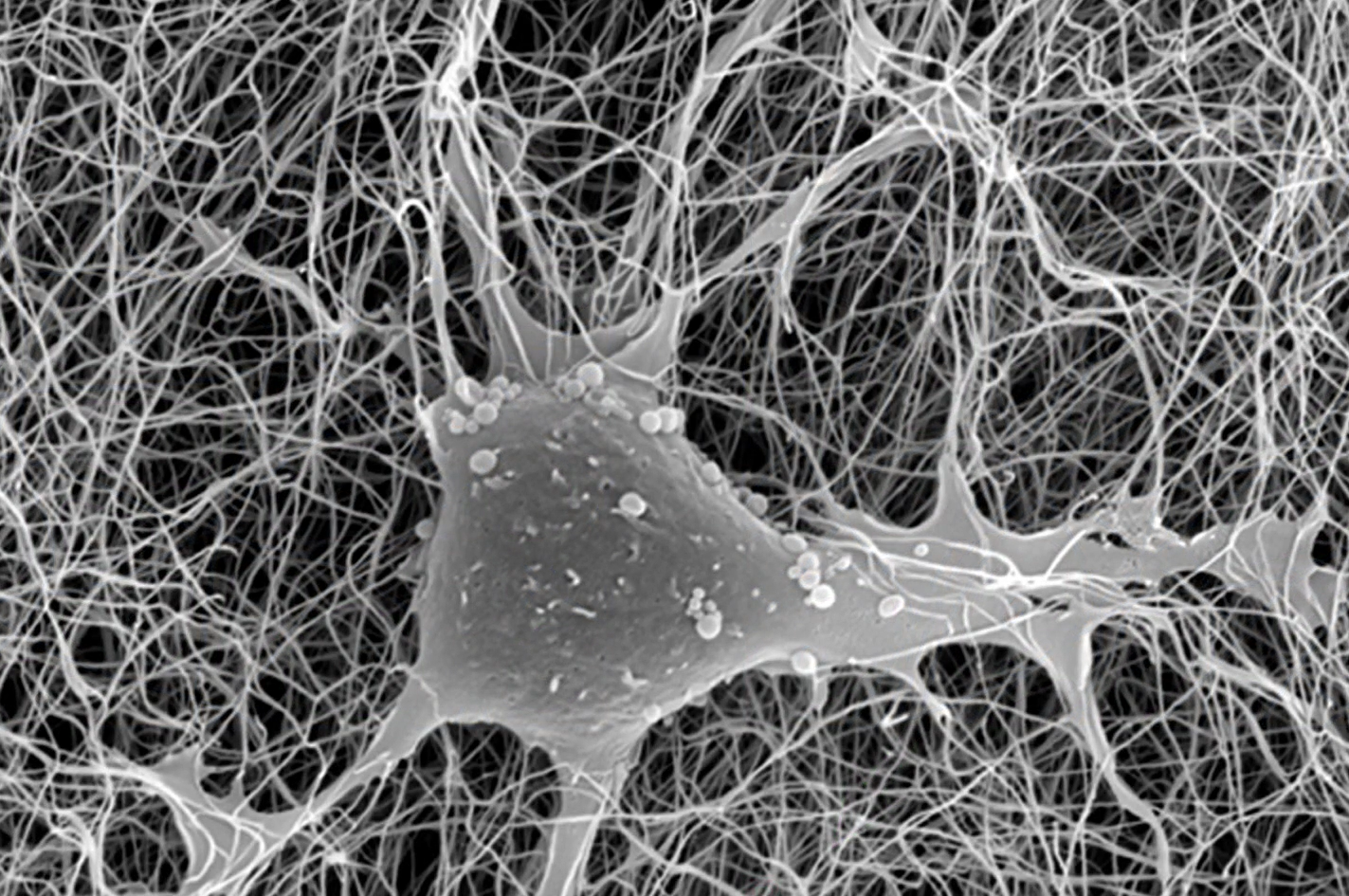 Fascia 201_05_Components of Fascia DO NOT USE YET