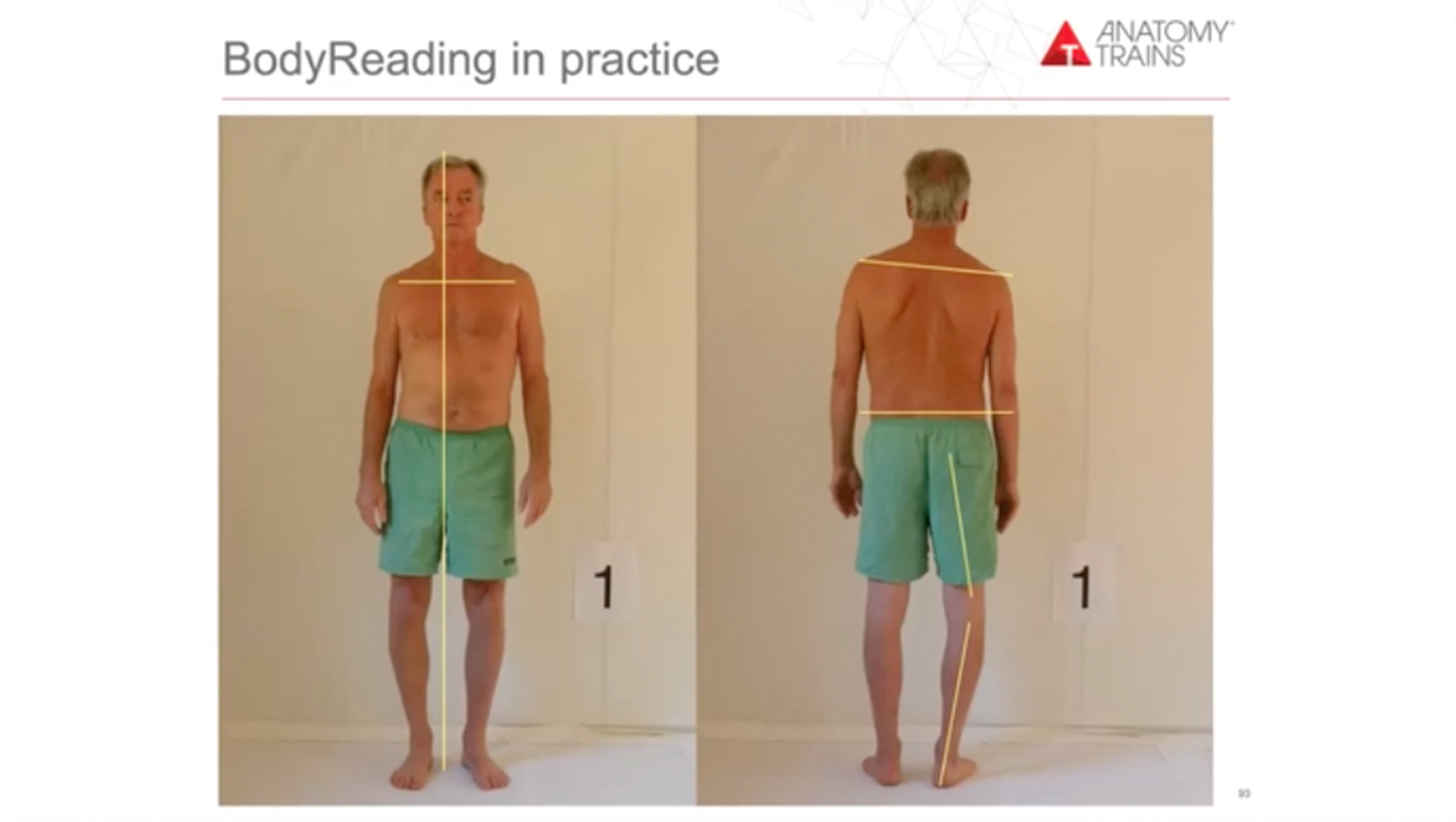 Tensegrity and BodyReading