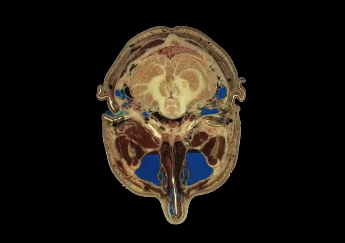 Fascia 201 Introduction