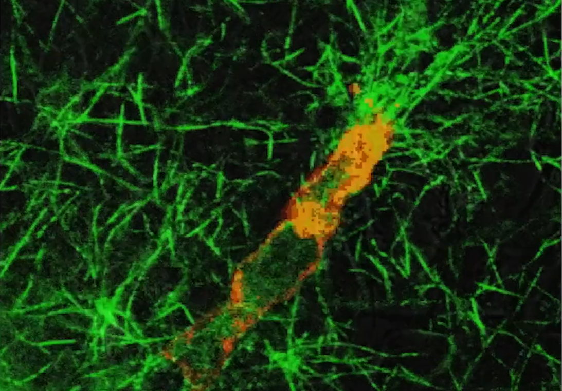 Fascia 201_06_The Hidden Secret of Bone DO NOT USE YET