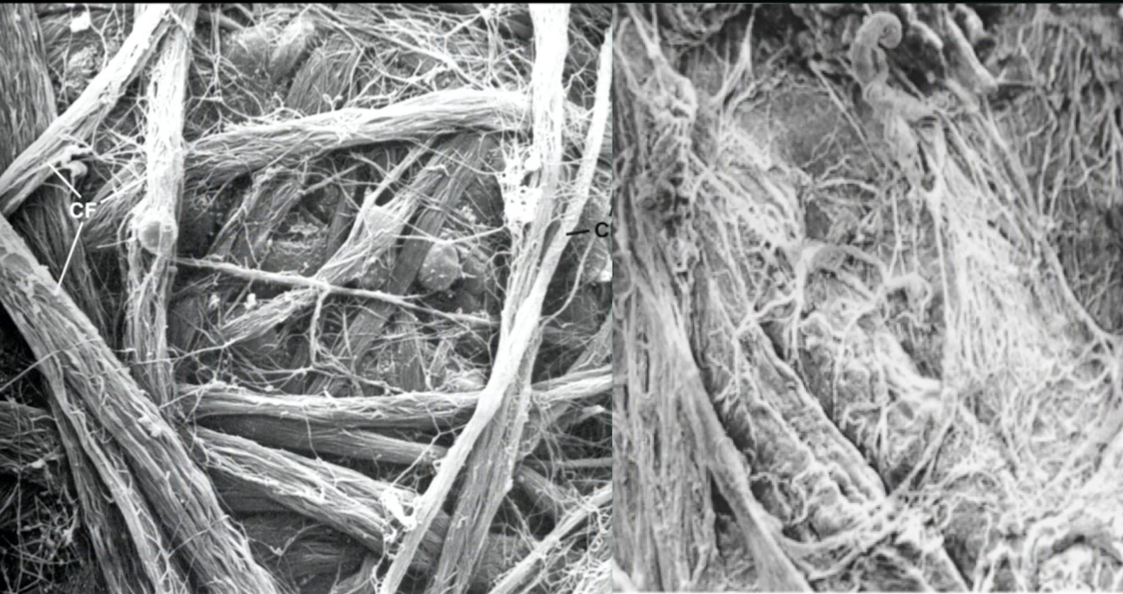 Fascia 201_09_Neuromotor Units DO NOT USE YET