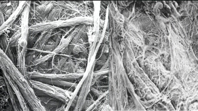 Fascia 201_09_Neuromotor Units DO NOT USE YET