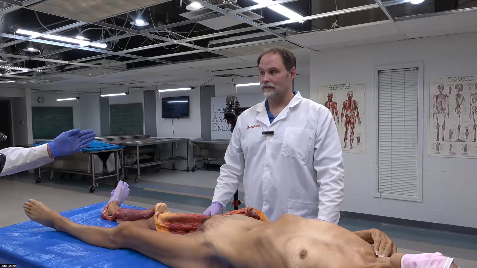 Fascial Compartments: Quadriceps