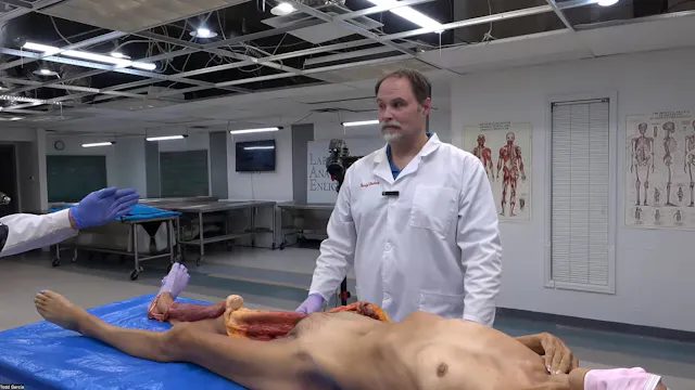 Fascial Compartments: Quadriceps