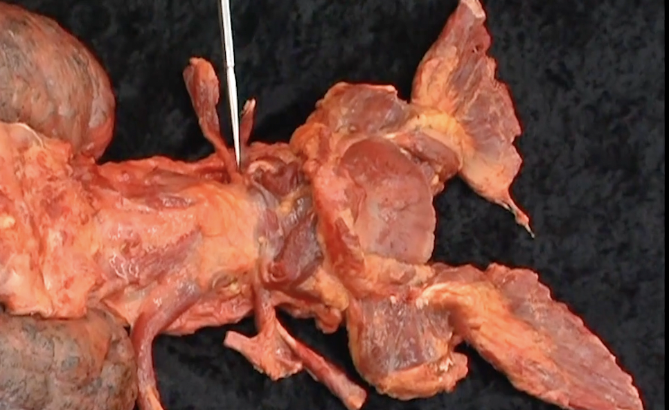 Anatomy Trains Revealed: Dissection