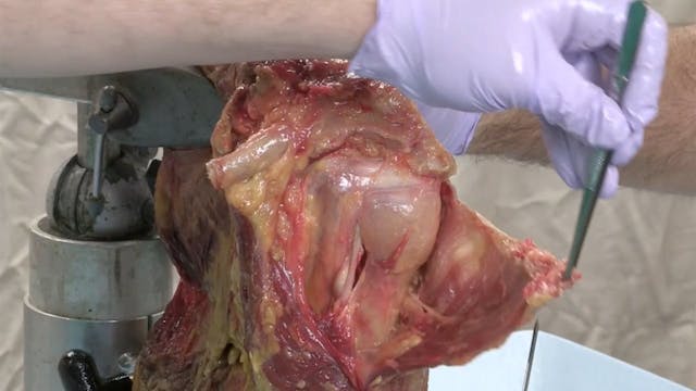 04302015 Cadaveric Video Demonstratio...