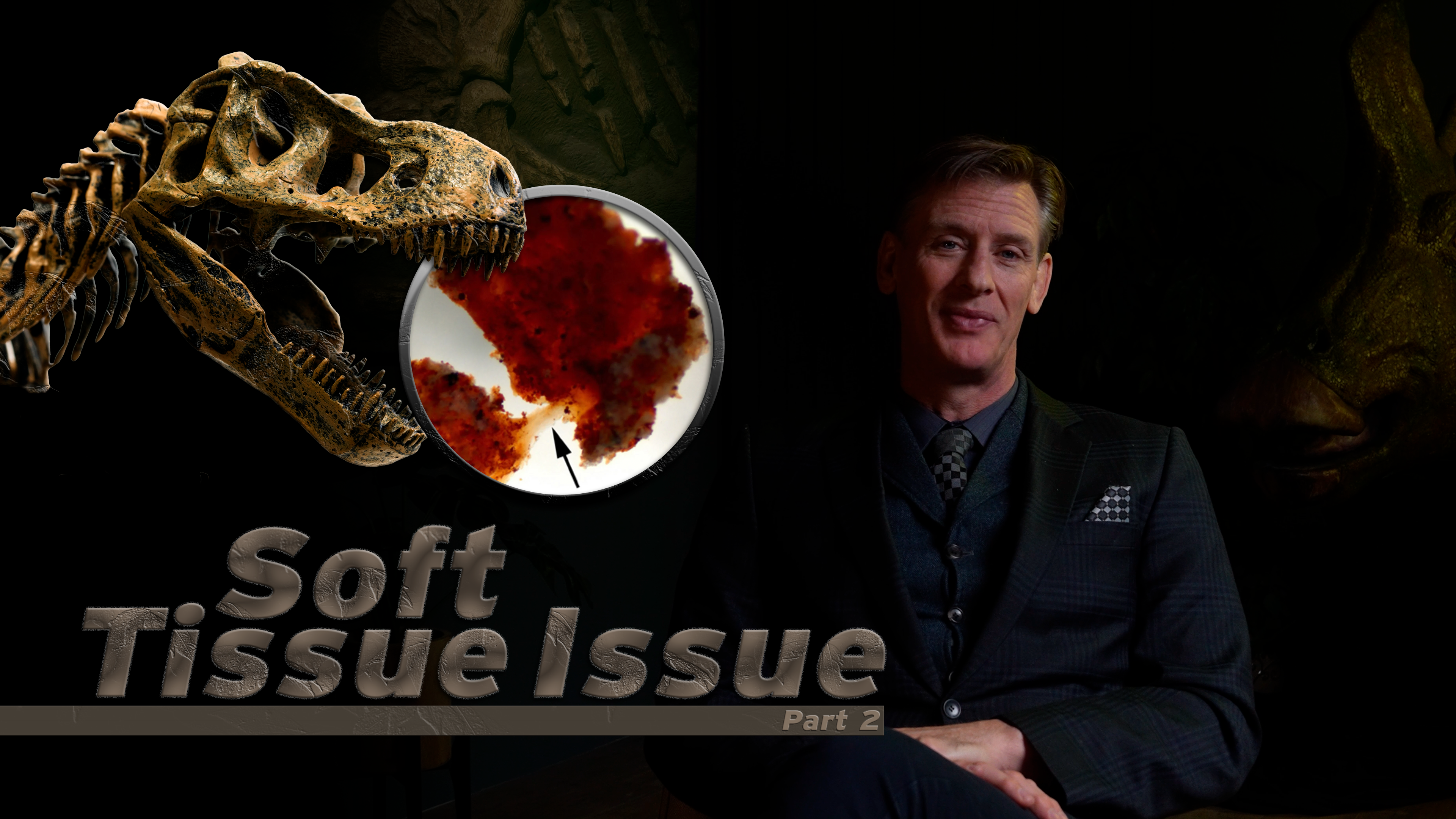 S6E11 Soft Tissue Issue Part 2