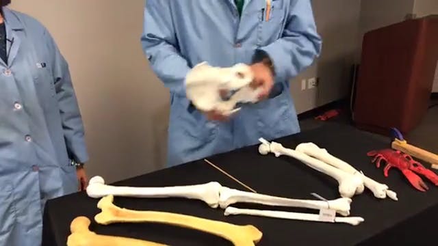 S1E25 The Knees Have It