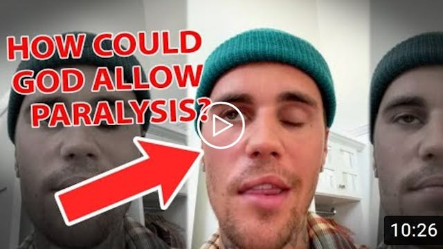 Justin Bieber's Face Paralysis - Why ...