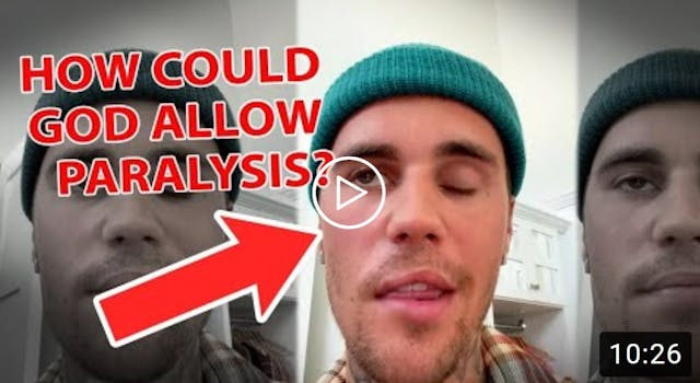 Justin Bieber's Face Paralysis - Why ...