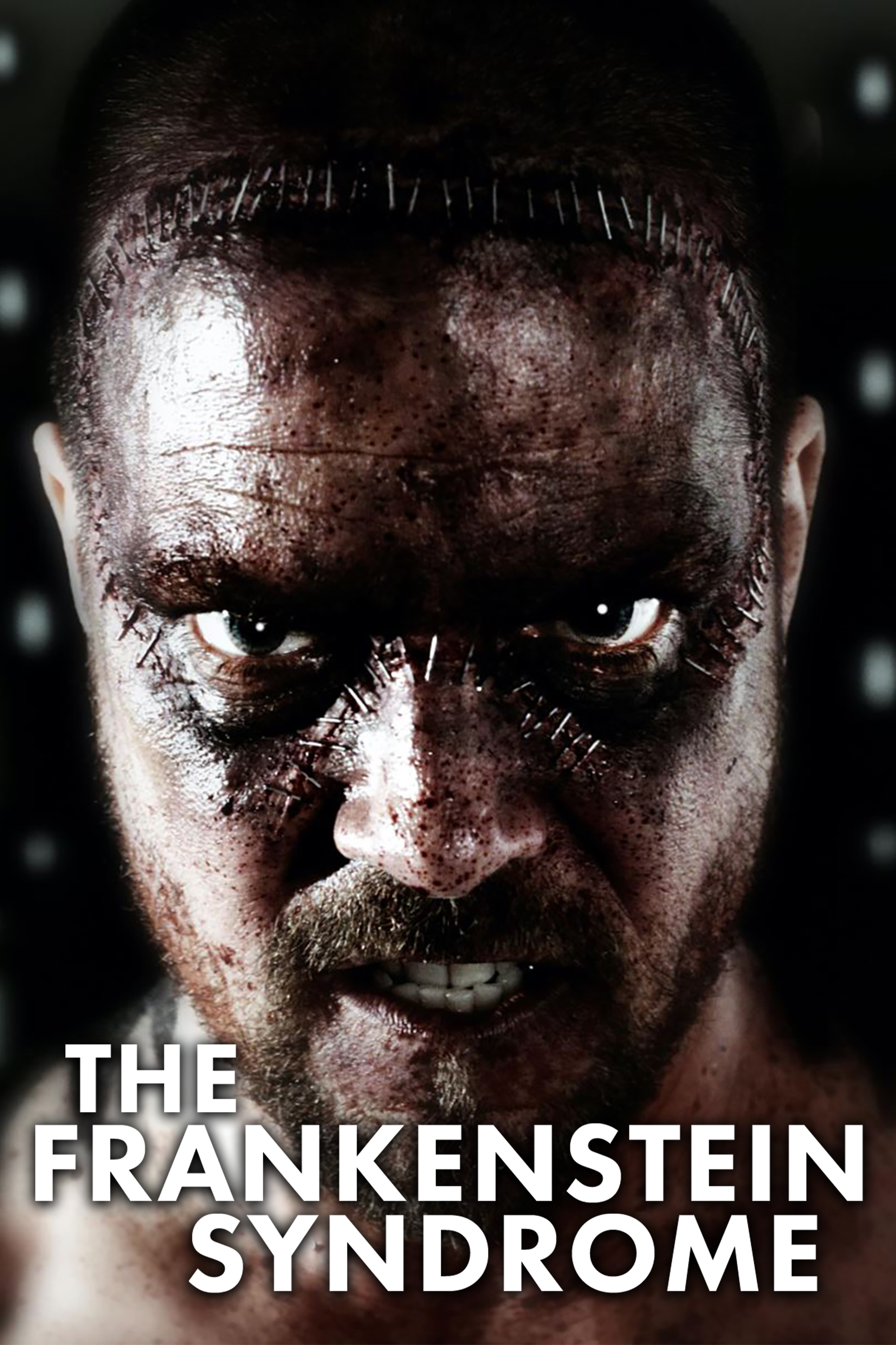 The Frankenstein Syndrome