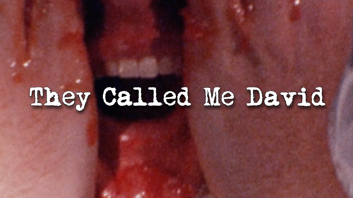 They Called Me David