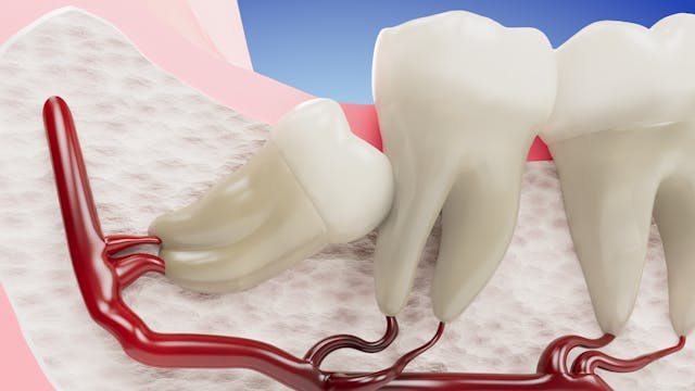 Oral Surgery