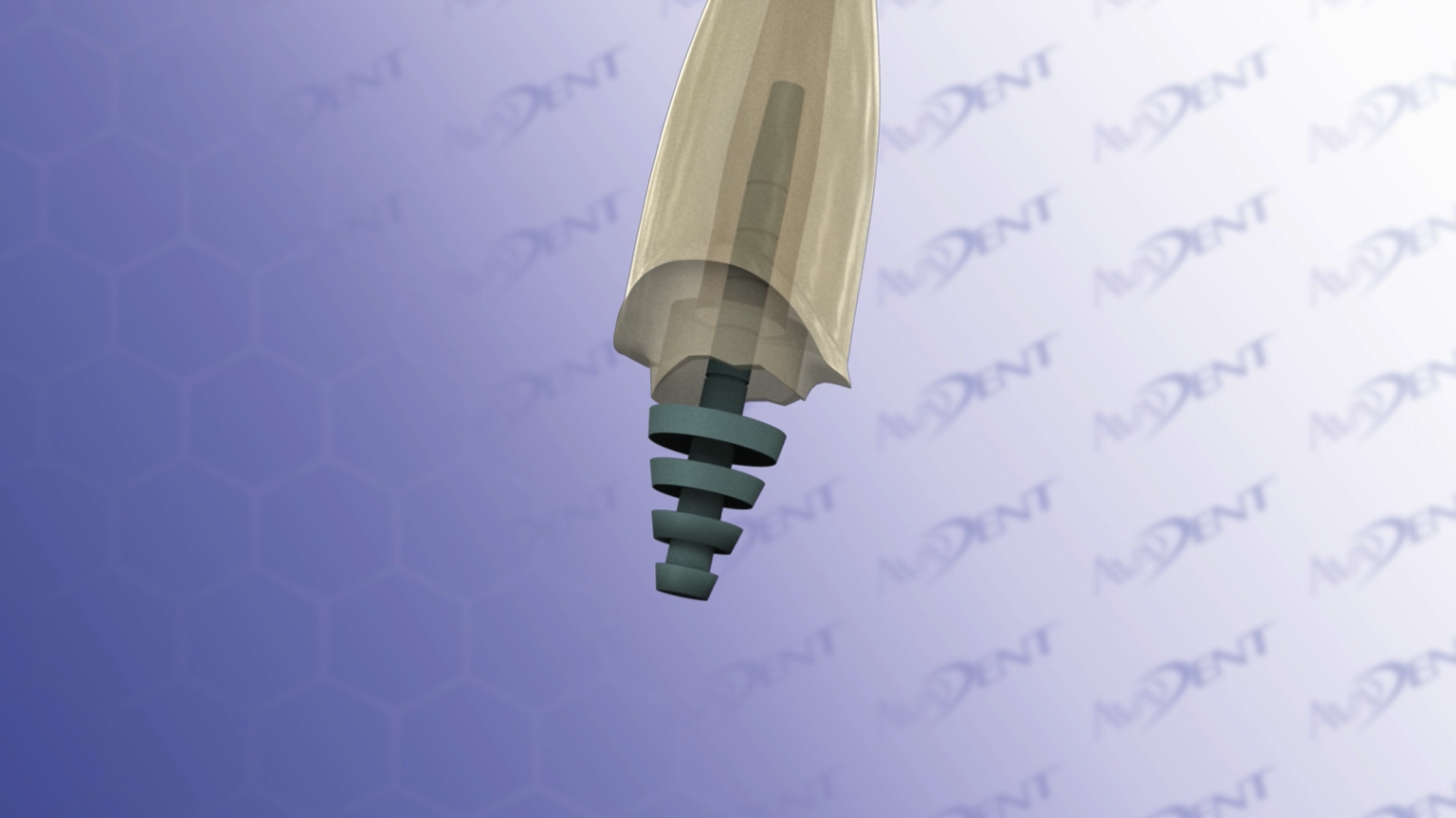 Prefabricated Post and Core with Crown