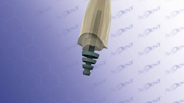 Prefabricated Post and Core with Crown