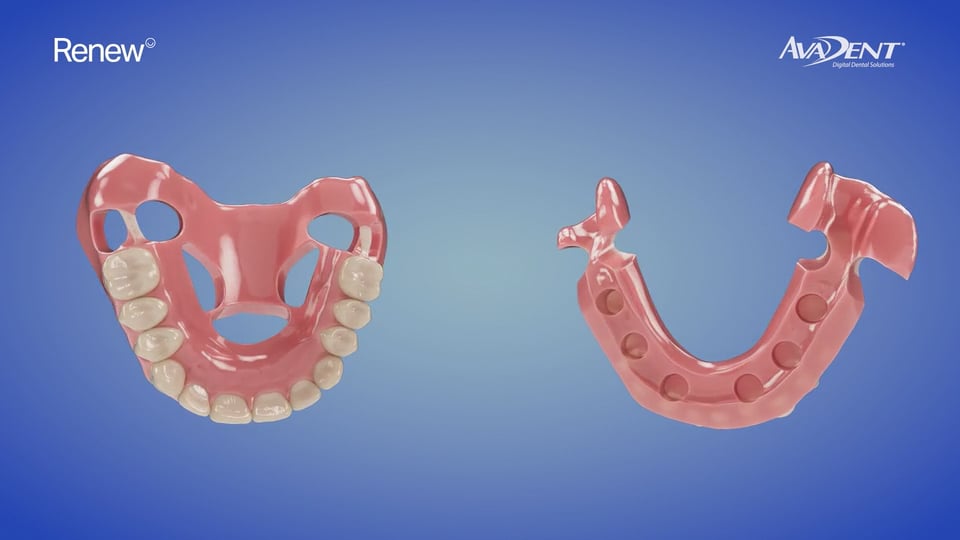 The Renew LOCATOR FIXED Hybrid Conversion Procedure
