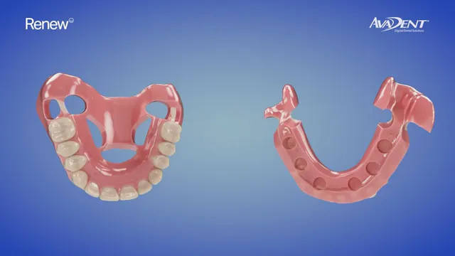 The Renew LOCATOR FIXED Hybrid Conver...