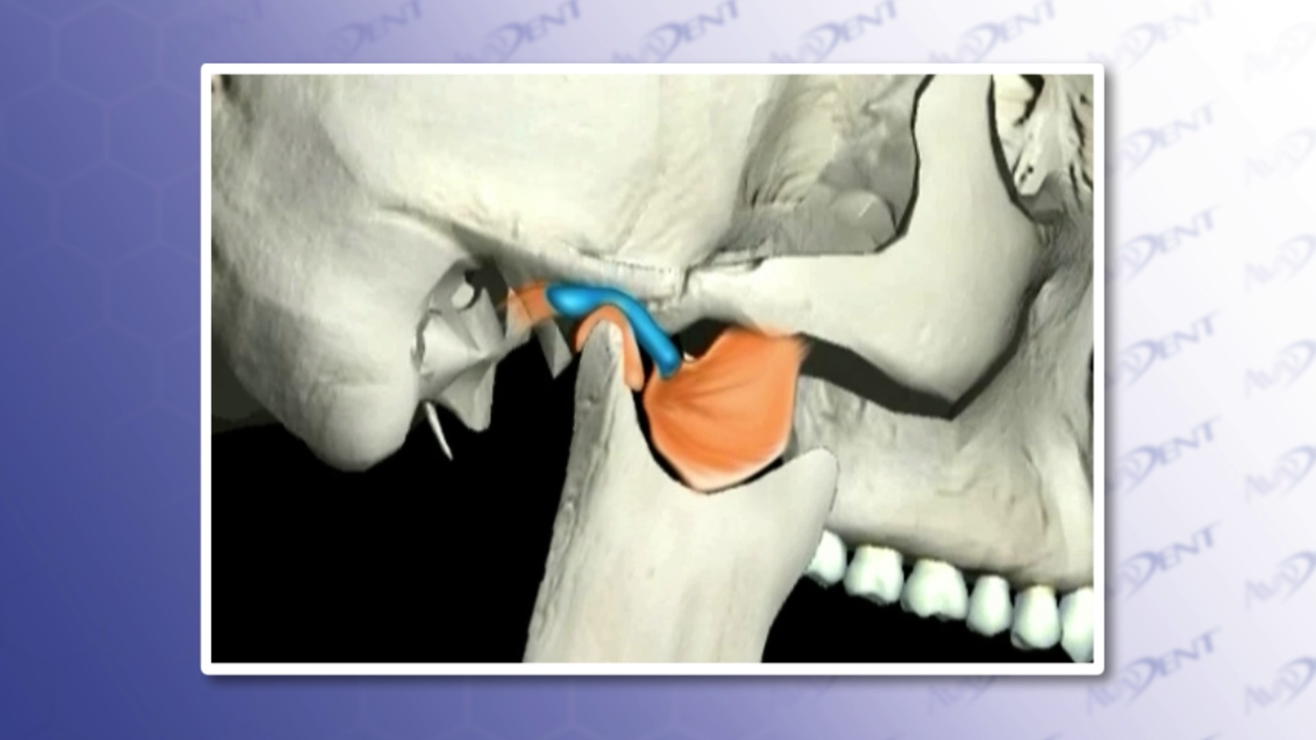 TMJ - Normal Function