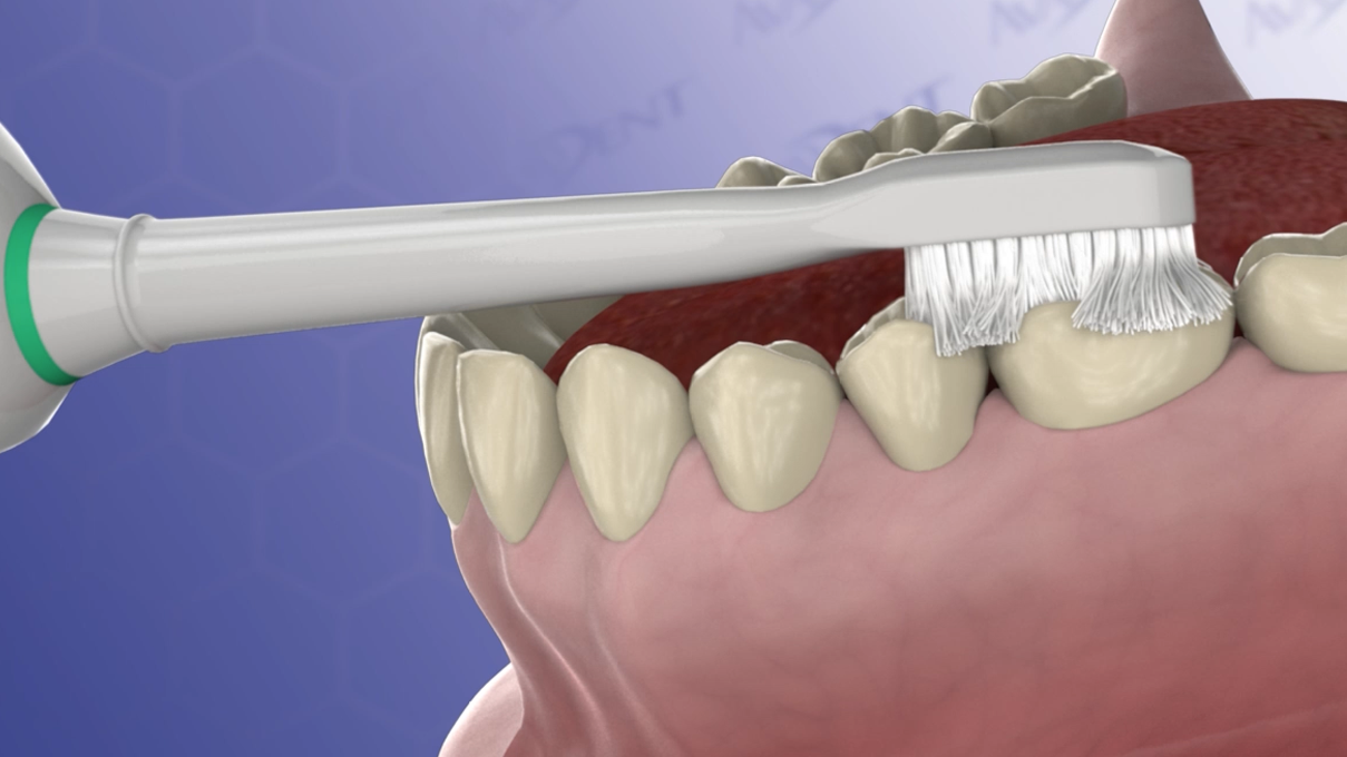 Brushing Your Teeth with an Electric Toothbrush