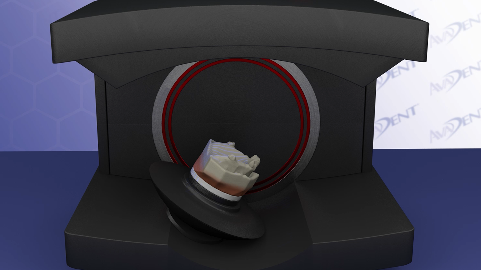 Desktop Scanning for Immediate Denture Protocol