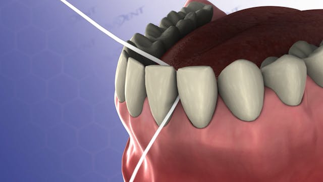 Flossing Technique