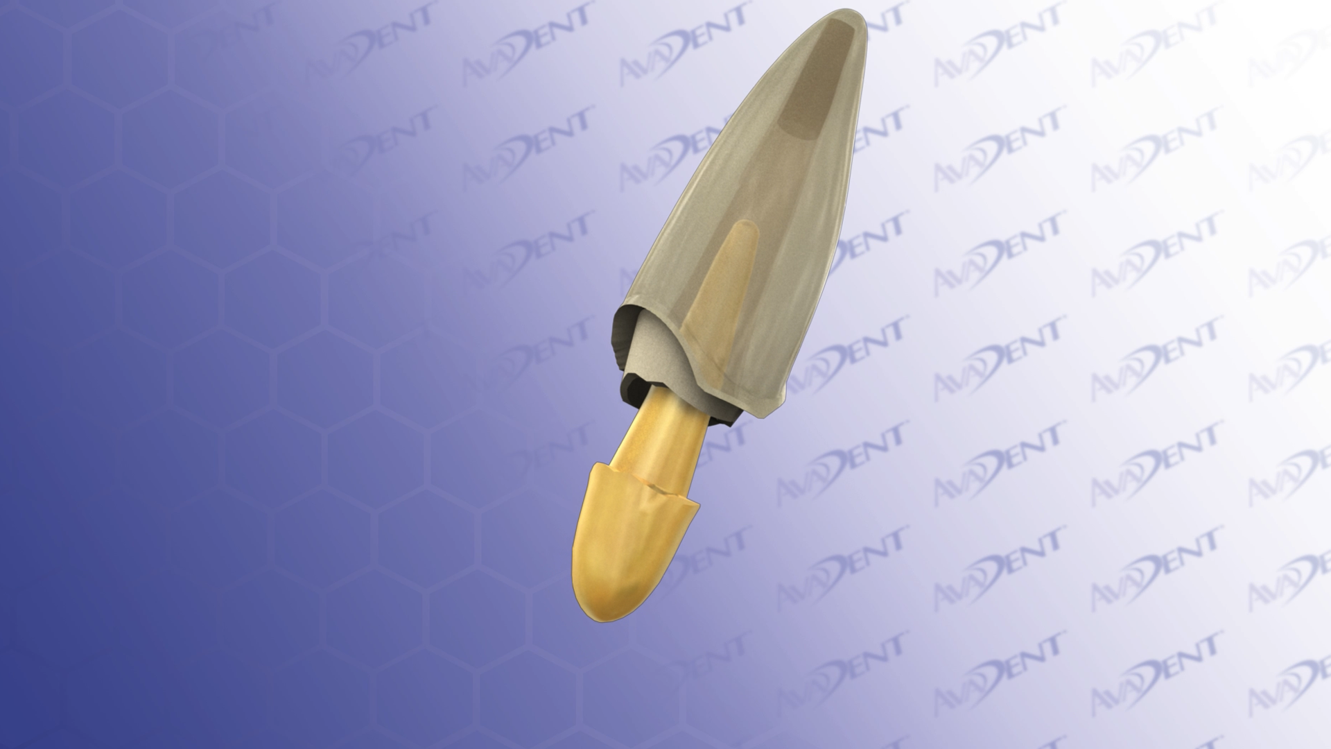 Cast Post and Core with Crown