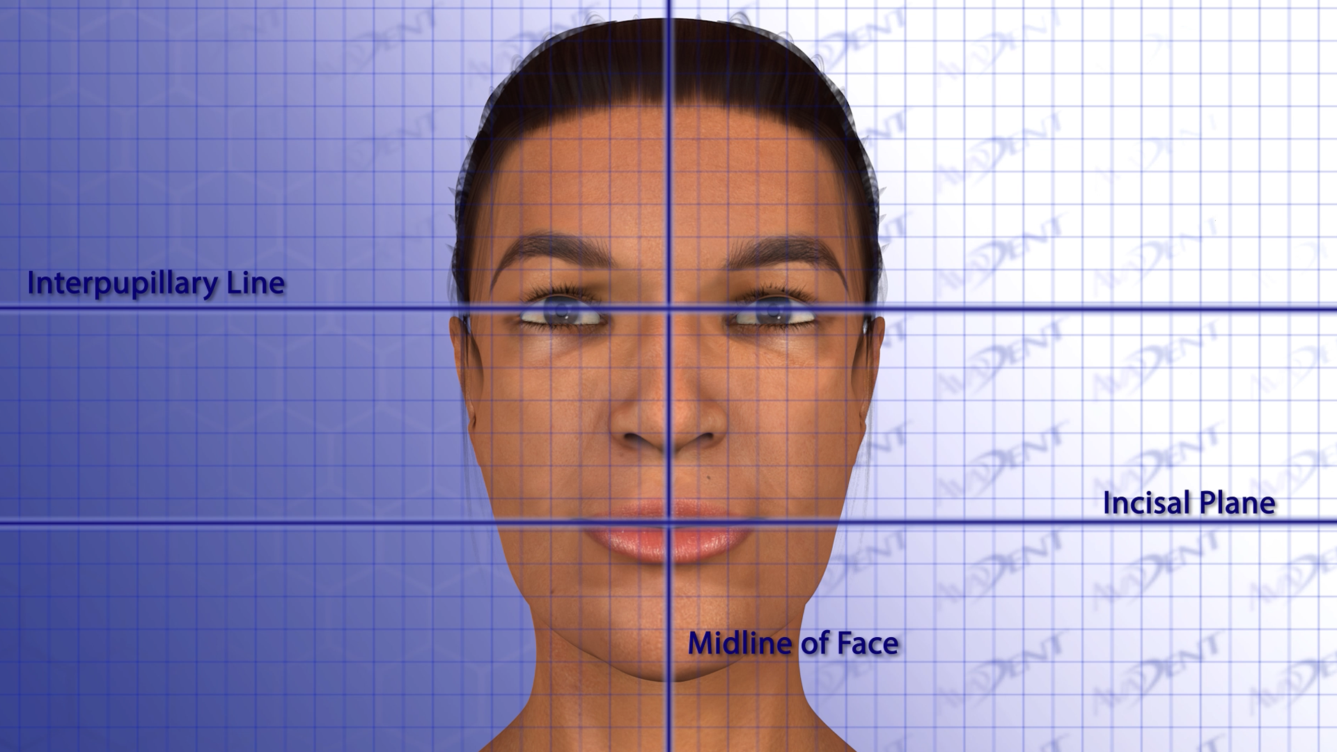 Smile Design Principles