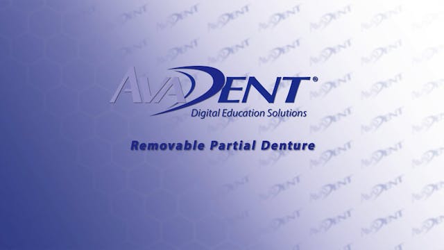Removable_Partial_Denture_new