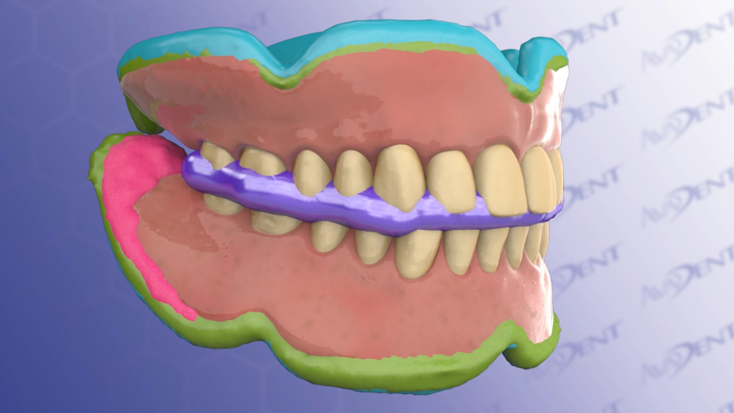BTI Three-Appointment Reference Denture Workflow