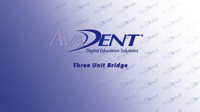 three_unit_bridge_new