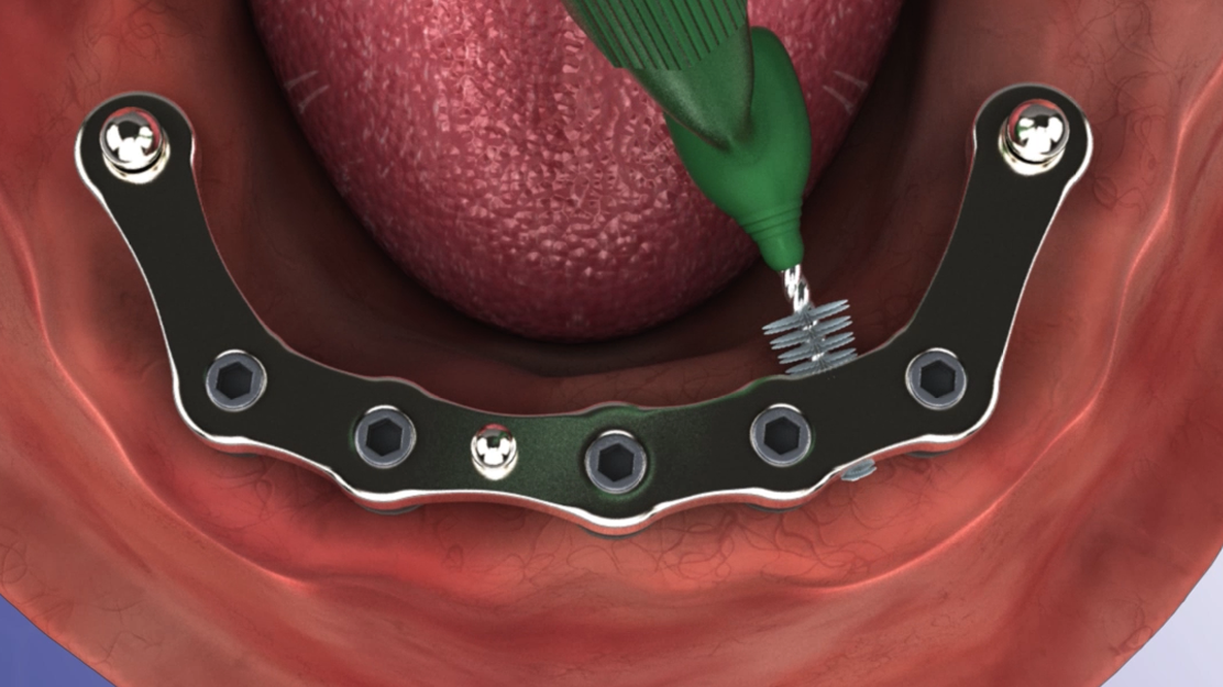 Cleaning Milled Bar Using a Proxy Brush