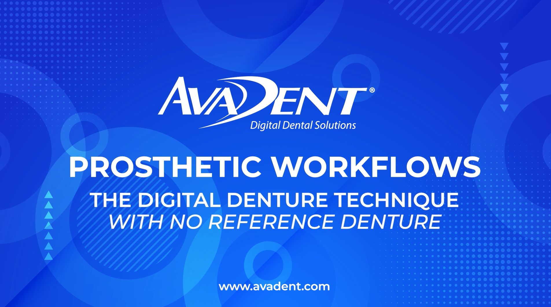 AvaDent Prosthetic Workflows: The Digital Denture Technique - No Ref. Denture