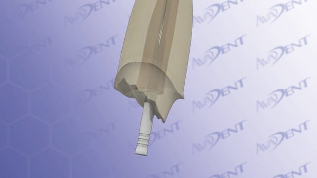 Esthetic Post and Core with Crown