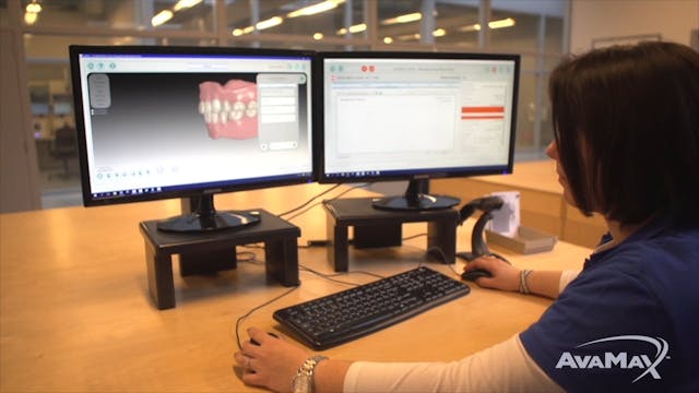 How Your AvaMax Smile Comes to Life