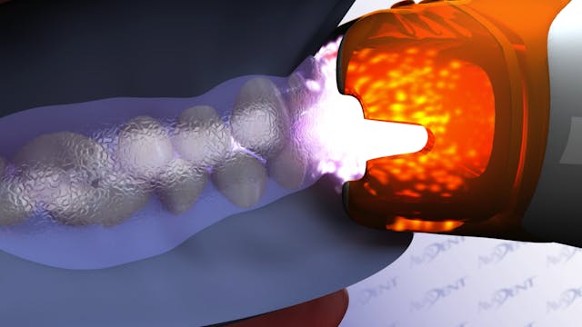Zoom! Whitening