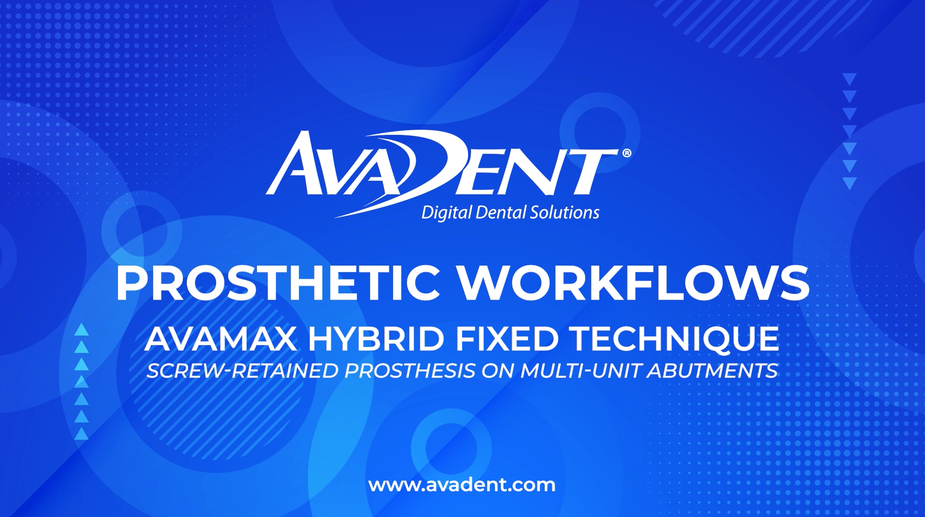 AvaDent Prosthetic Workflows: AvaMax Hybrid Fixed Technique