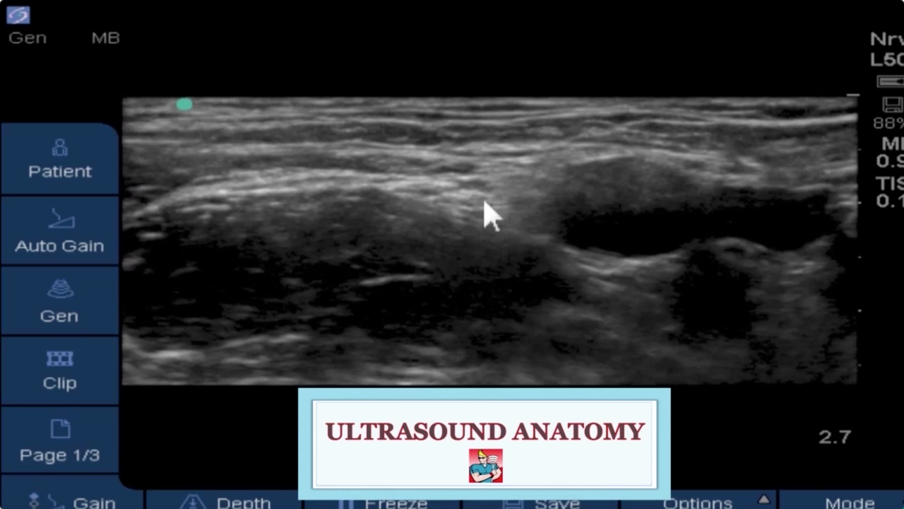 Femoral Virtual Ultrasound Workshop