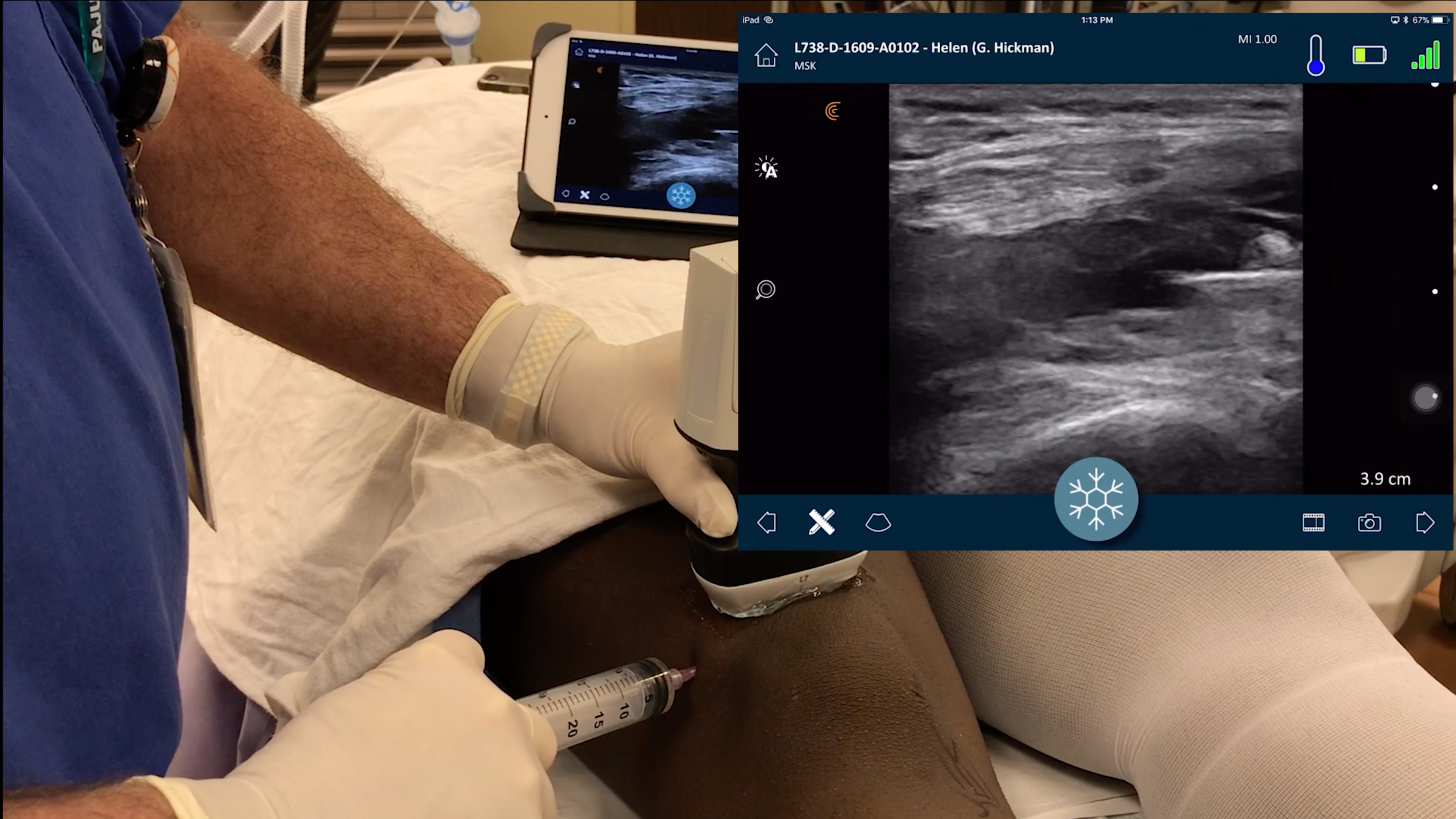 Musculoskeletal (MSK) Ultrasound