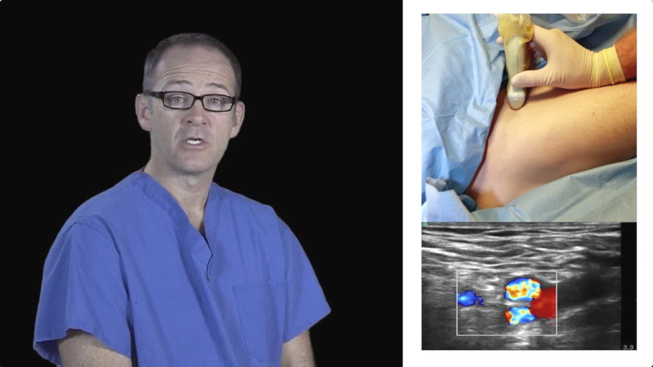 How to Perform an Ultrasound-Guided Femoral Nerve Block