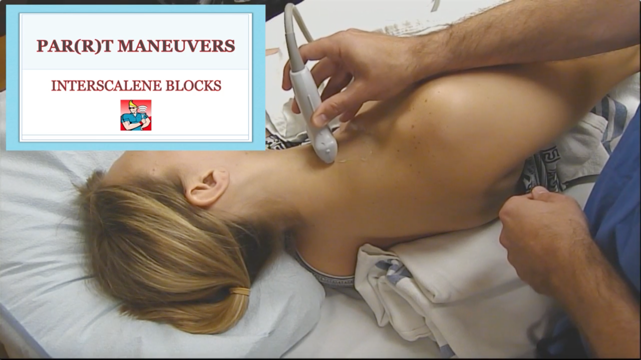 Interscalene Virtual Ultrasound Workshop