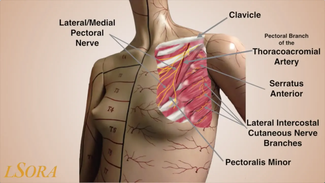 LSORA Ultrasound guided PECS II (2) Block - Free Didactic & Demo Videos ...