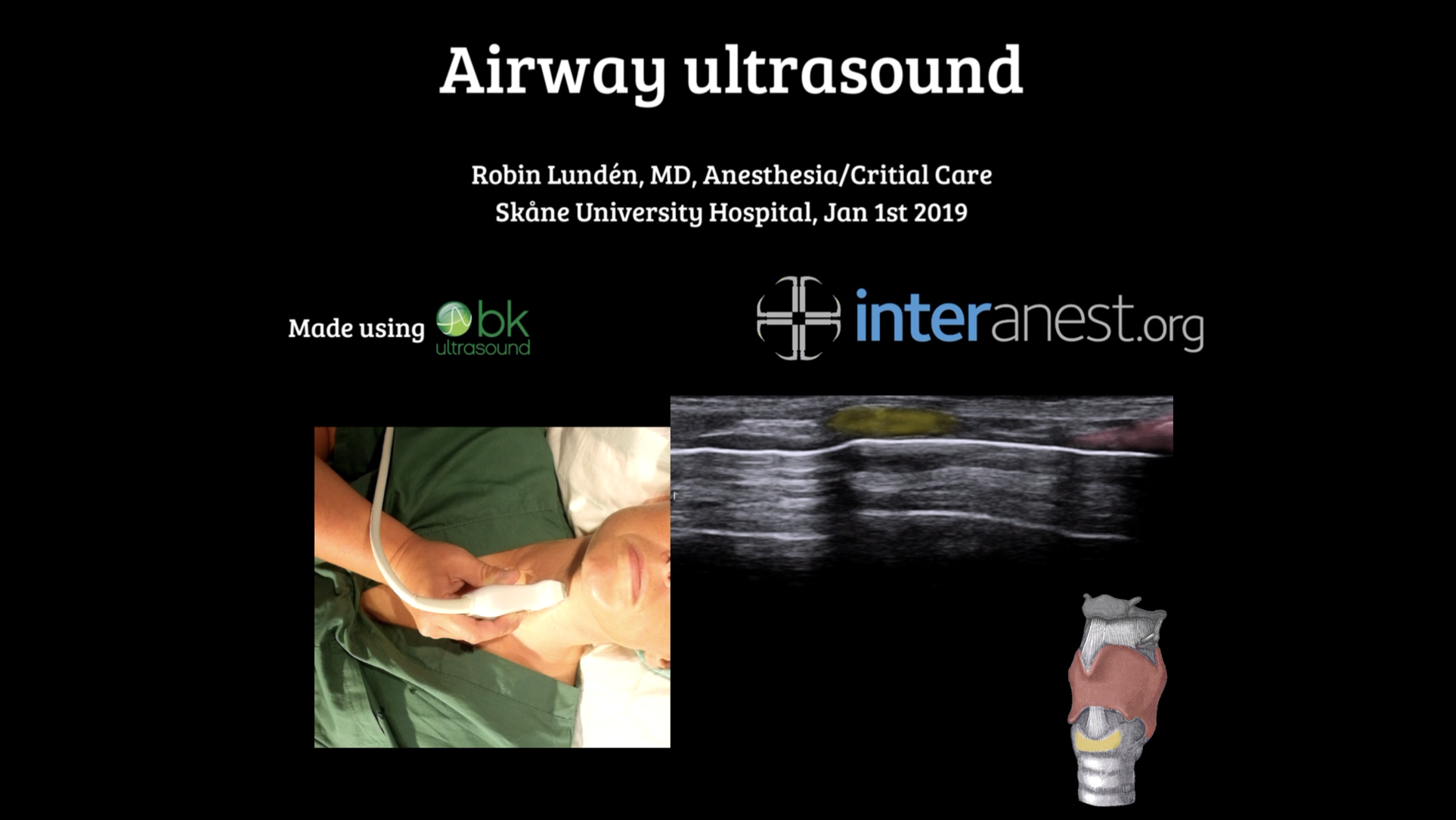 *NEW* Airway Ultrasound