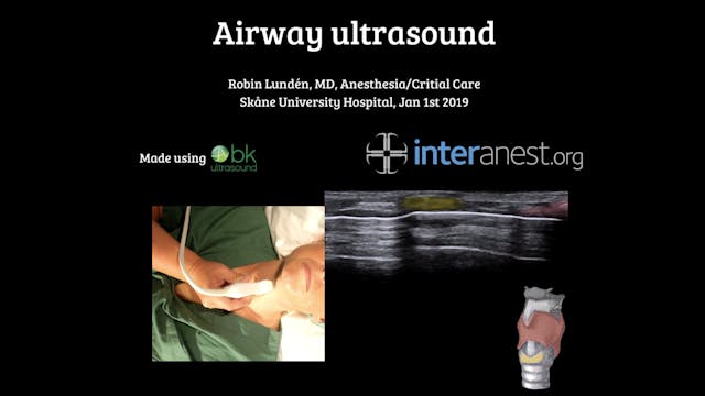 *NEW* Airway Ultrasound