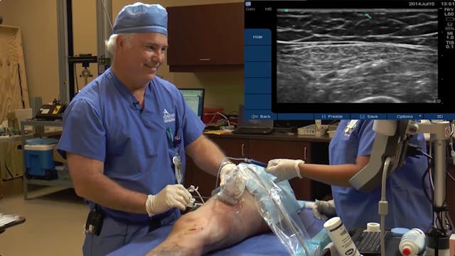 VIP Cadaver Demo- Assessing the Sprea...