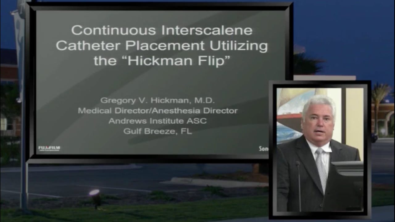 The "Hickman Flip" for Interscalene Catheter Placement inar Teaser