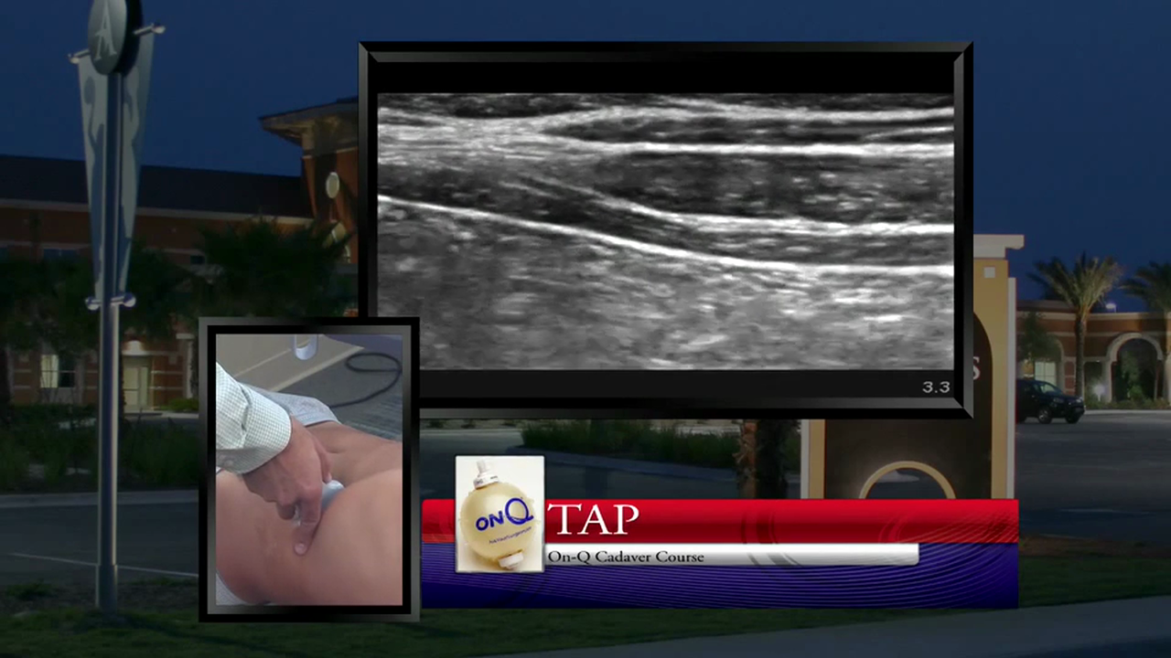 Transversus Abdominis Plane (TAP) Scanning Demonstration