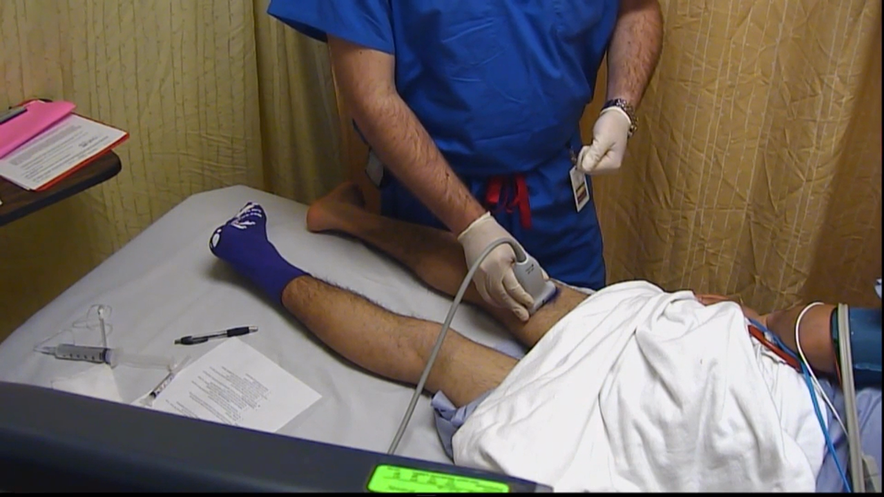 Optimizing Nerve & Needle Visualization Duration a Popliteal Sciatic Block