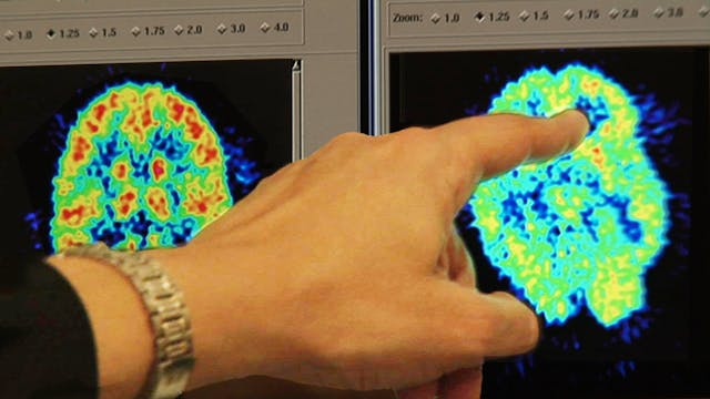 Causes of BPD Trailer