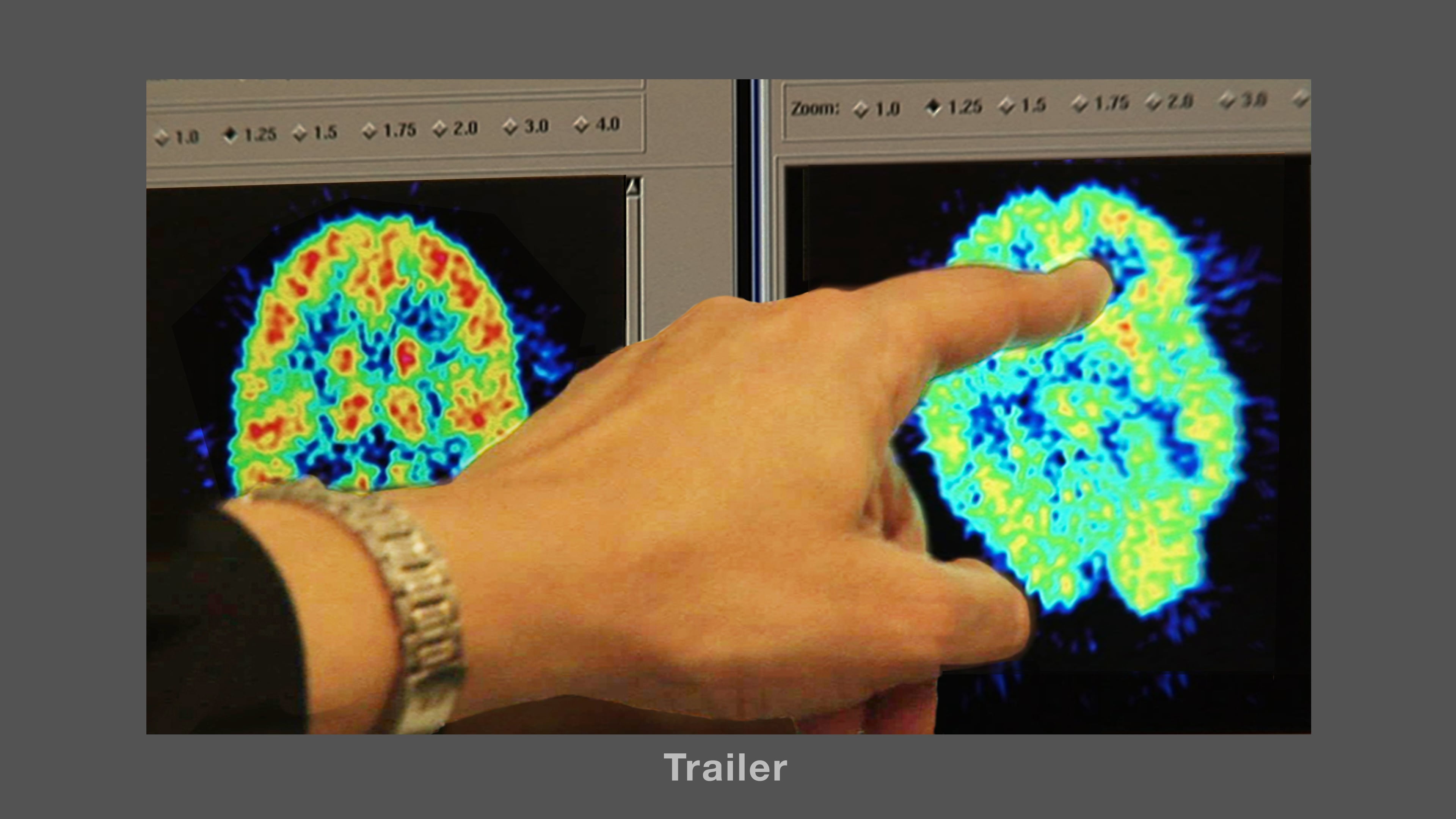 Causes of BPD - Trailer